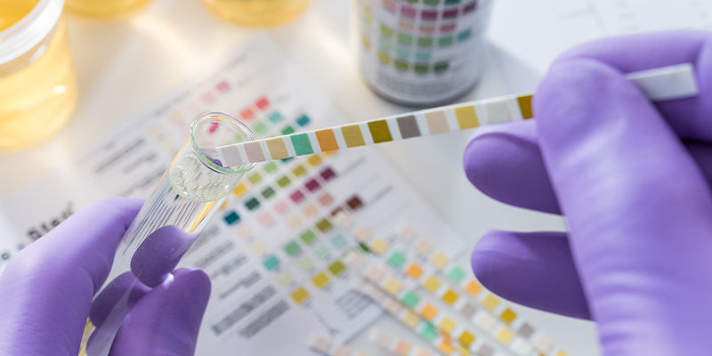 Kommer kratom att synas på ett drogtest? Will kratom show up on a drug test?
