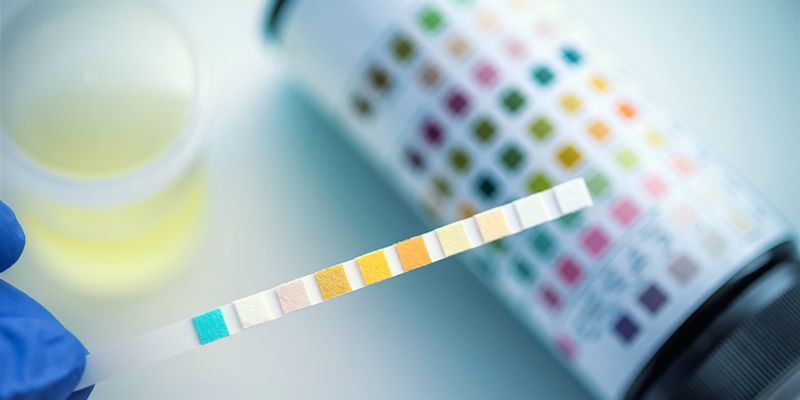 Drogtester i idrotten: THC och CBD Drogtester i idrotten: THC och CBD
