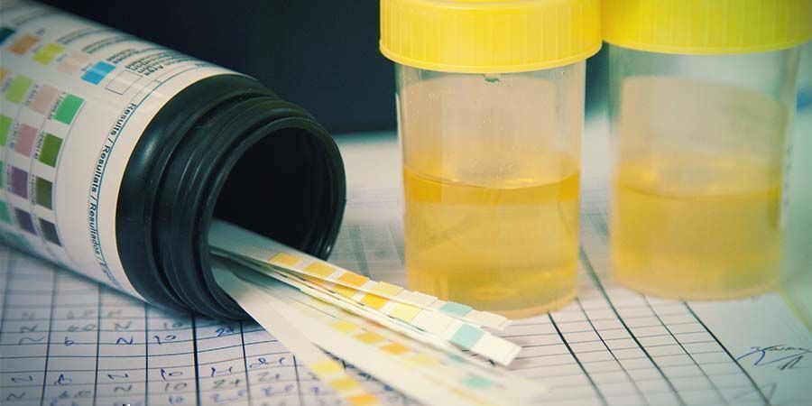 Urin drug testing methods: Urine