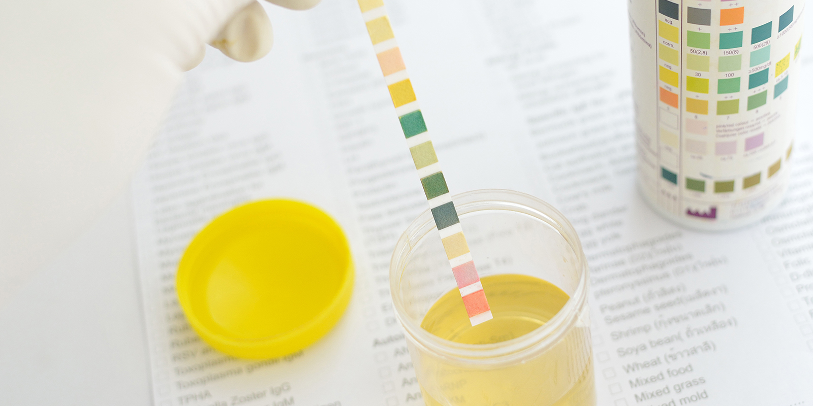 Halvsanningar: Detoxdrycker, provbyte & syntetiskt urin Halvsanningar: Detoxdrycker, provbyte & syntetiskt urin