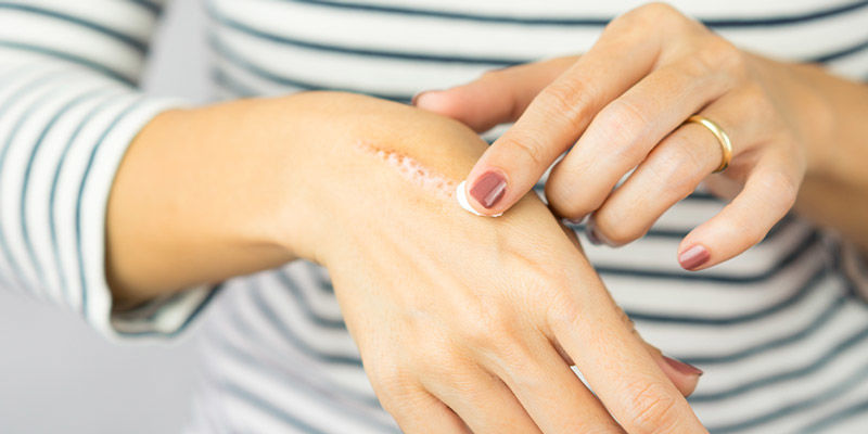 Se Brûler Ou Attraper Le Clou À Mains Nues Se Brûler Ou Attraper Le Clou À Mains Nues