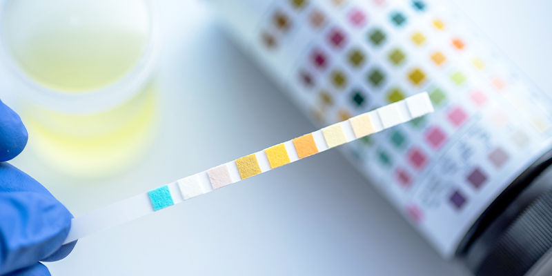 Hur fungerar THC-drogtester? Hur fungerar THC-drogtester?