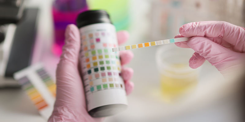 Kratom drogtestning Kratom drug testing