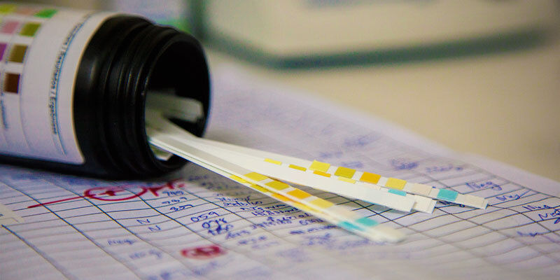 Saliv- och urintest för droger Saliva and Urine Drug Testing