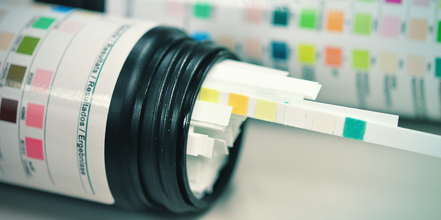 Interaktion mellan CBD-kapslar, drogtester och medicin Interaktion mellan CBD-kapslar, drogtester och medicin